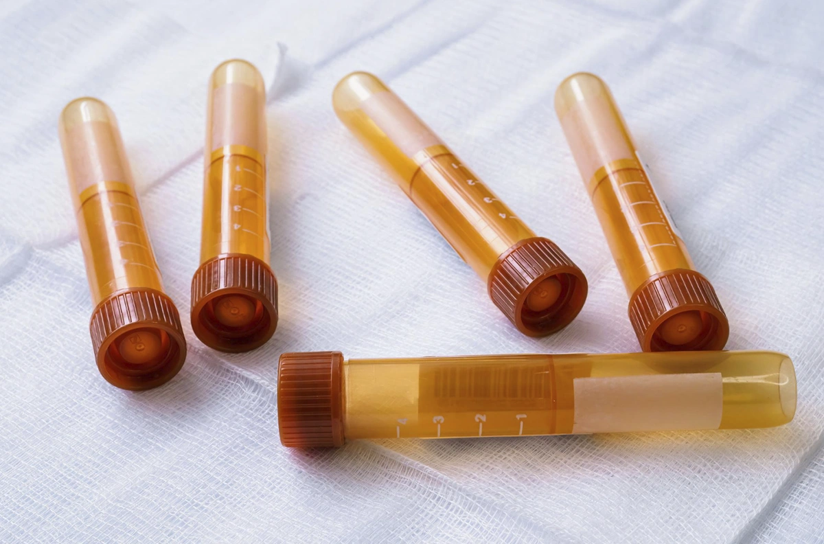 tubos de ensayo para muestras